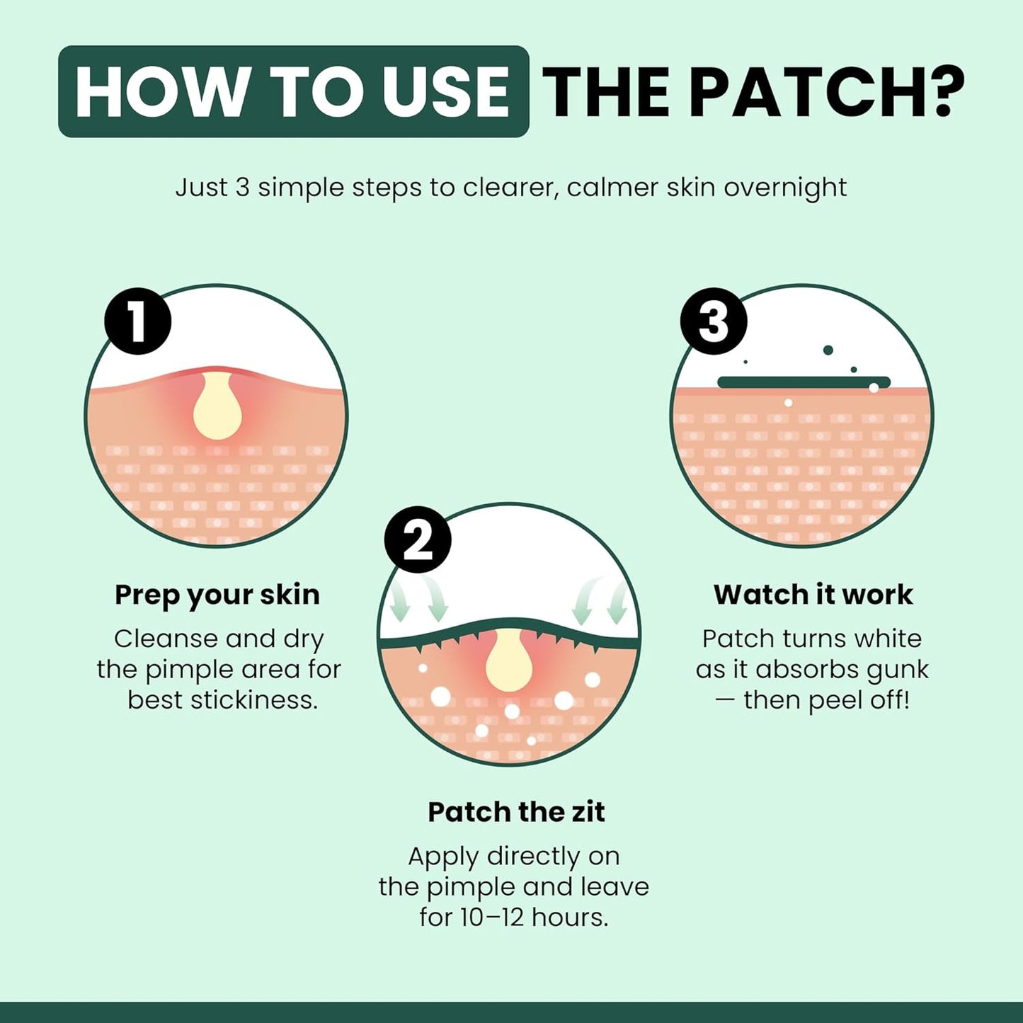 TheraSkin Pimple Patches | Korean Formulation Hypoallergenic | Micro Needle Patch | Hydrocolloid Waterproof Patches | Absorbs Excess Oil | Pimple & Acne Overnight | Invisible 9 Patches
